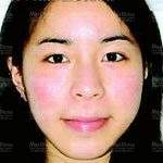 個案10：Nicole 治療後