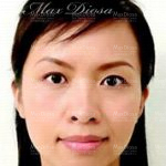 個案1：Karen 治療後