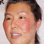 個案9：Jenny 治療前