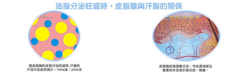 當皮脂腺的皮脂分泌旺盛時,汗腺的汗液分泌自然減少。75%油:25%水。皮脂腺皮脂過量分泌,令皮膚油膩且嚴重缺水及易引發炎症、暗瘡。 當皮脂腺的皮脂分泌旺盛時,汗腺的汗液分泌自然減少。75%油:25%水。皮脂腺皮脂過量分泌,令皮膚油膩且嚴重缺水及易引發炎症、暗瘡。