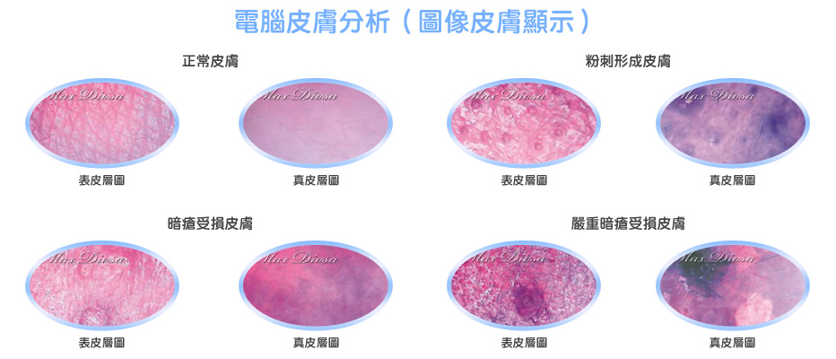 電腦皮膚分析(圖像皮膚顯示) 電腦皮膚分析(圖像皮膚顯示)